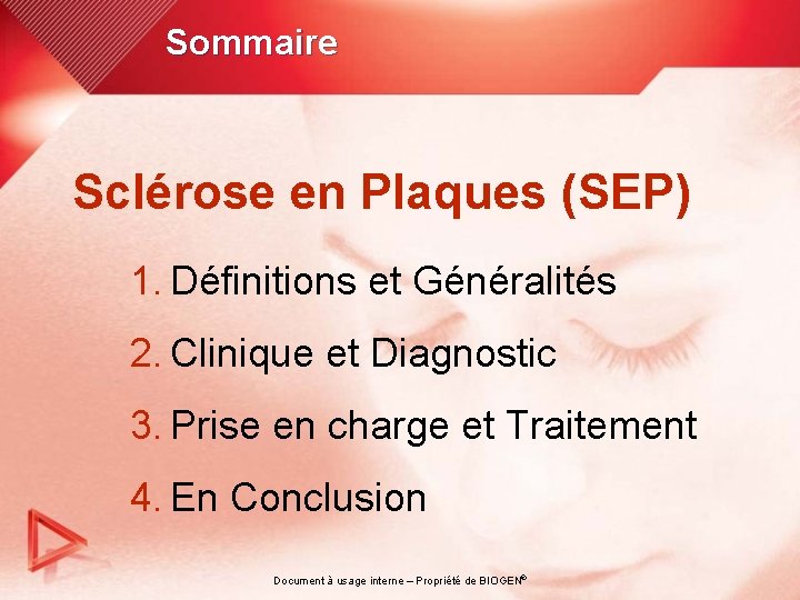Sommaire Sclérose en Plaques (SEP) 1. Définitions et Généralités 2. Clinique et Diagnostic 3.