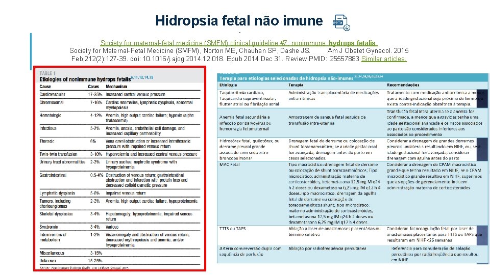 Hidropsia fetal não imune Society for maternal-fetal medicine (SMFM) clinical guideline #7: nonimmune hydrops