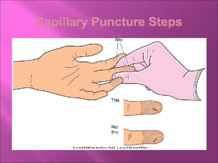 Capillary Puncture Steps 