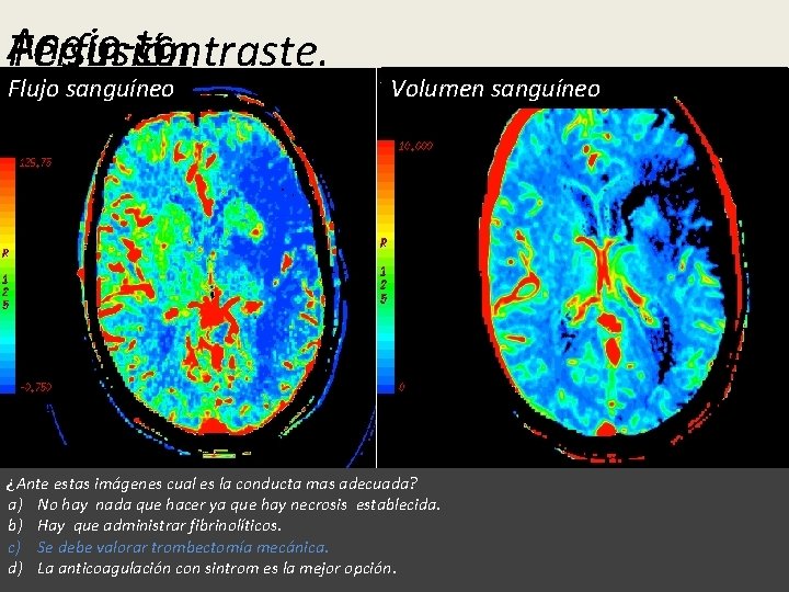 Angio-tc TC Perfusión sin contraste. Flujo MIp sanguíneo Volumen Ventanasanguíneo ictus ¿Ante estas imágenes