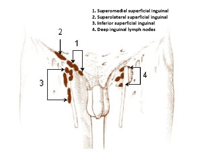 1. Superomedial superficial inguinal 2. Superolateral superficial inguinal 3. Inferior superficial inguinal 4. Deep