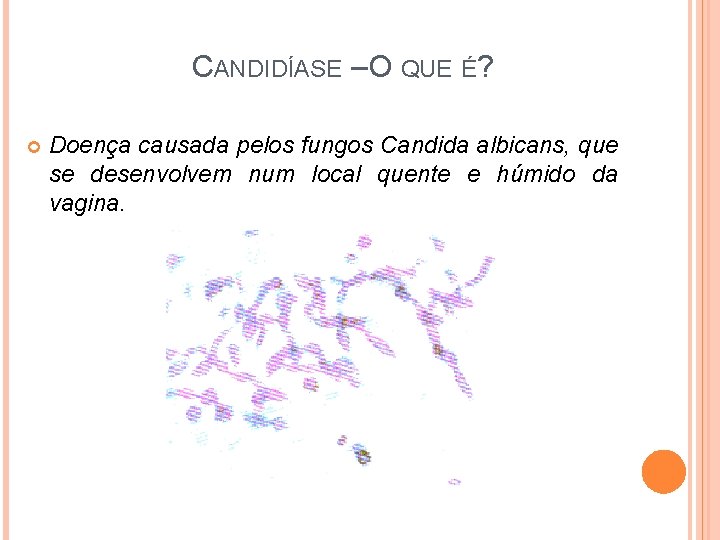 CANDIDÍASE – O QUE É? Doença causada pelos fungos Candida albicans, que se desenvolvem