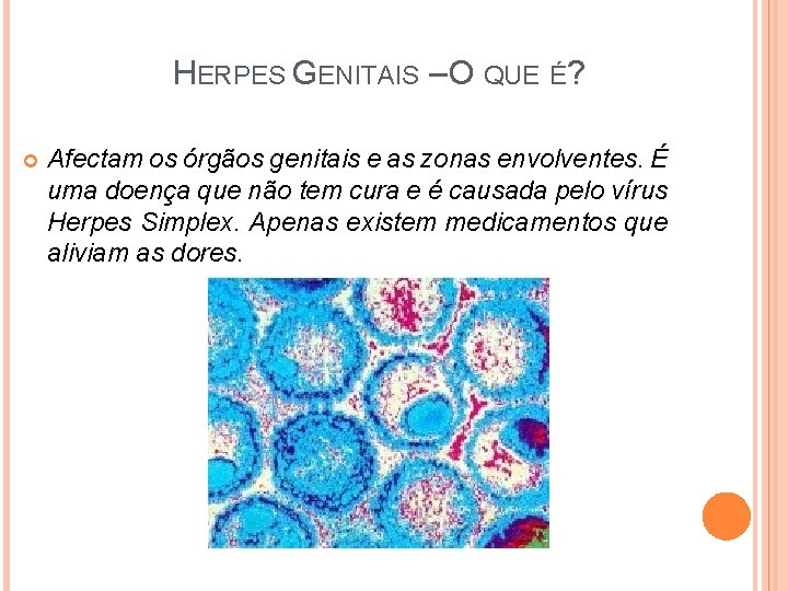 HERPES GENITAIS – O QUE É? Afectam os órgãos genitais e as zonas envolventes.