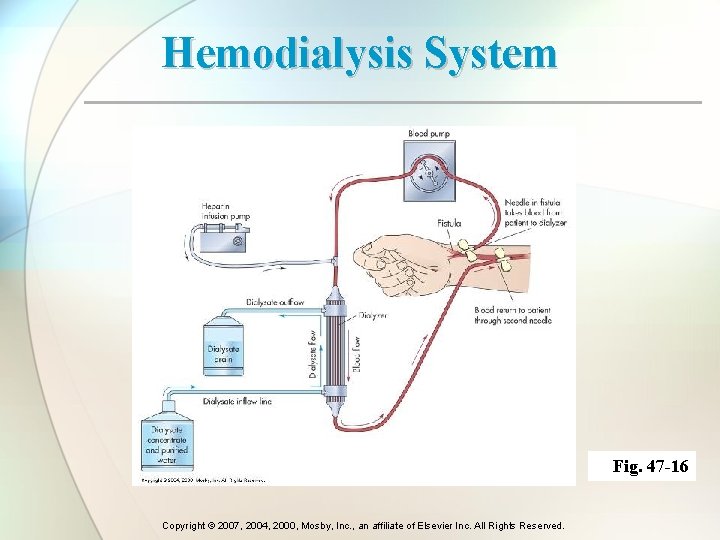 Hemodialysis System Fig. 47 -16 Copyright © 2007, 2004, 2000, Mosby, Inc. , an