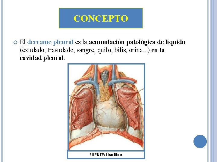 CONCEPTO El derrame pleural es la acumulación patológica de líquido (exudado, trasudado, sangre, quilo, CONCEPTO El derrame pleural es la acumulación patológica de líquido (exudado, trasudado, sangre, quilo,