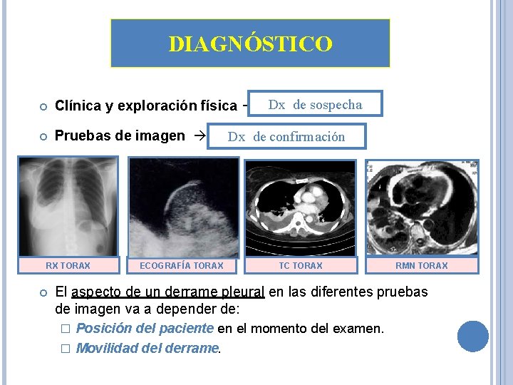 DIAGNÓSTICO Clínica y exploración física Dx de sospecha Pruebas de imagen RX TORAX ECOGRAFÍA DIAGNÓSTICO Clínica y exploración física Dx de sospecha Pruebas de imagen RX TORAX ECOGRAFÍA