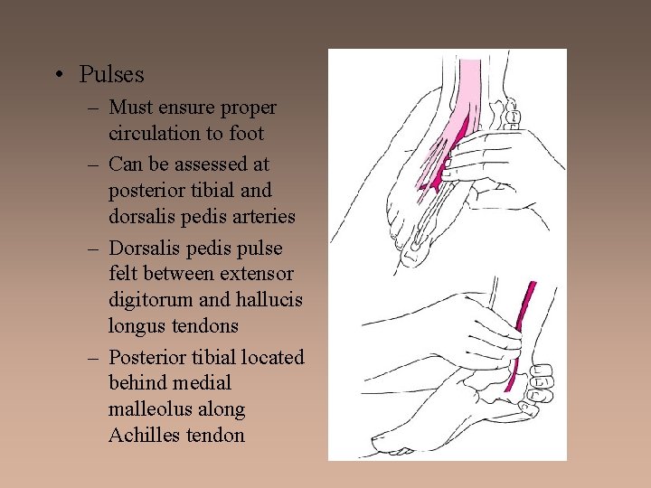  • Pulses – Must ensure proper circulation to foot – Can be assessed