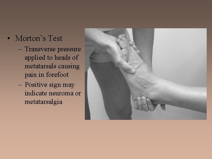  • Morton’s Test – Transverse pressure applied to heads of metatarsals causing pain