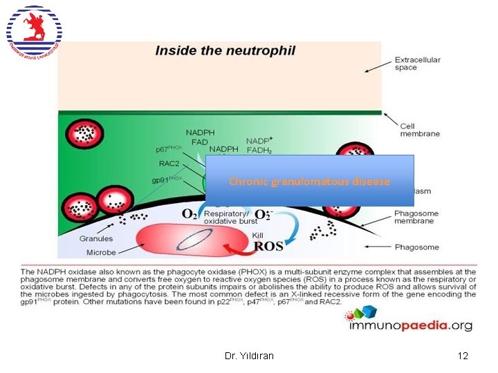 Chronic granulomatous disease Dr. Yıldıran 12 