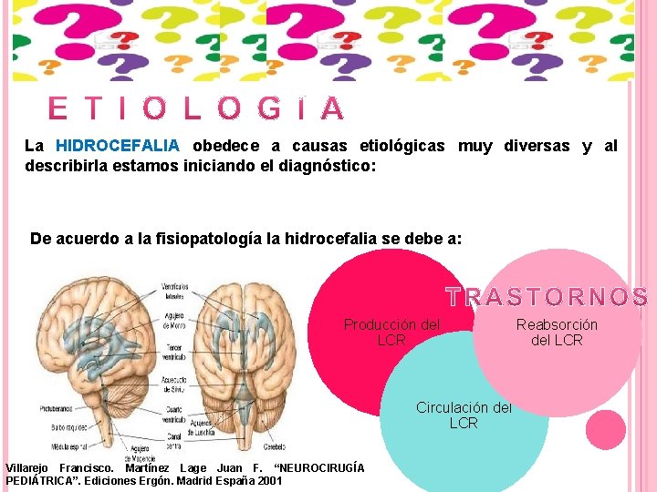 La HIDROCEFALIA obedece a causas etiológicas muy diversas y al describirla estamos iniciando el