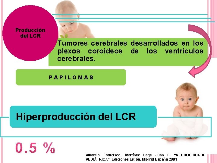 Producción del LCR Tumores cerebrales desarrollados en los plexos coroideos de los ventrículos cerebrales.