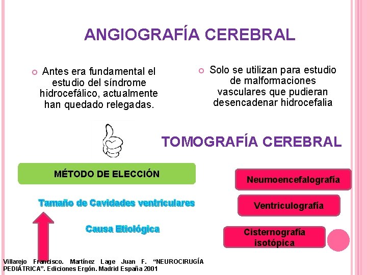 ANGIOGRAFÍA CEREBRAL Antes era fundamental el estudio del síndrome hidrocefálico, actualmente han quedado relegadas.