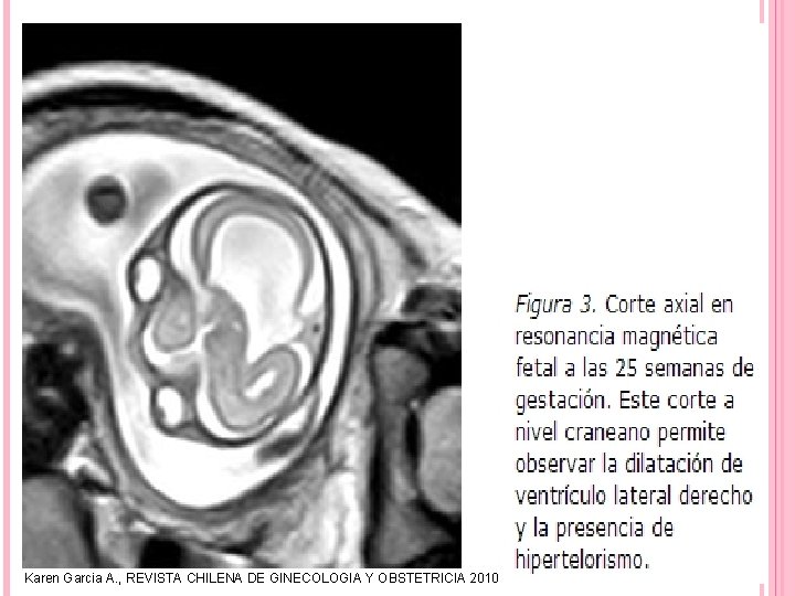 Karen Garcia A. , REVISTA CHILENA DE GINECOLOGIA Y OBSTETRICIA 2010 