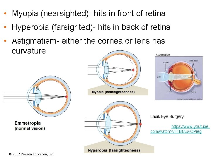 • Myopia (nearsighted)- hits in front of retina • Hyperopia (farsighted)- hits in • Myopia (nearsighted)- hits in front of retina • Hyperopia (farsighted)- hits in