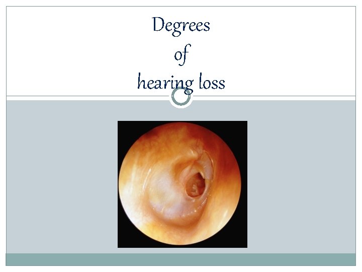 Degrees of hearing loss 