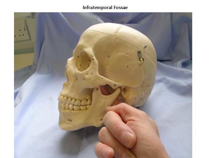 Infratemporal Fossae 