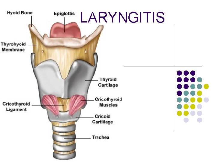 LARYNGITIS 