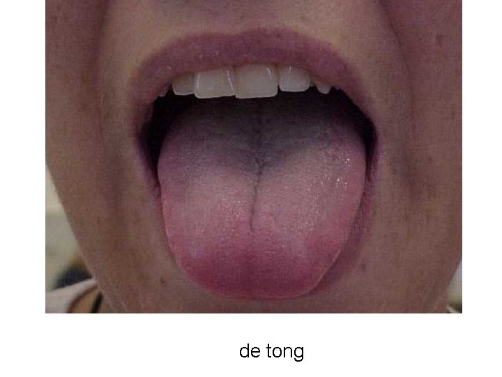 de tong 