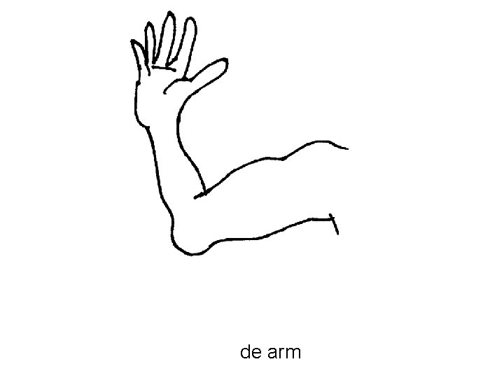 de arm 