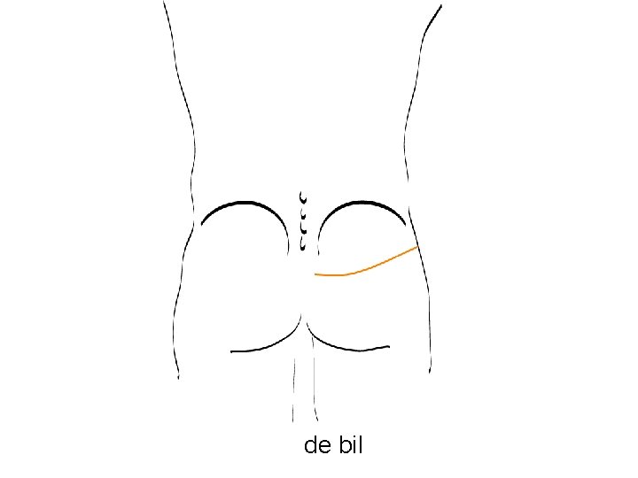 de bil 