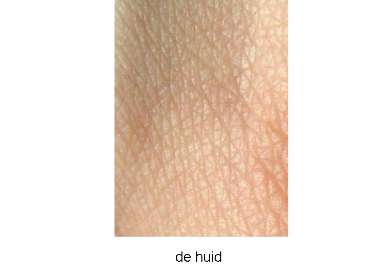 de huid 