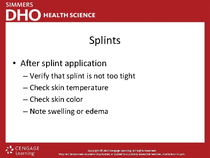 Splints • After splint application – Verify that splint is not too tight –