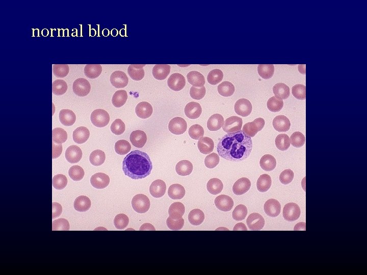 normal blood 