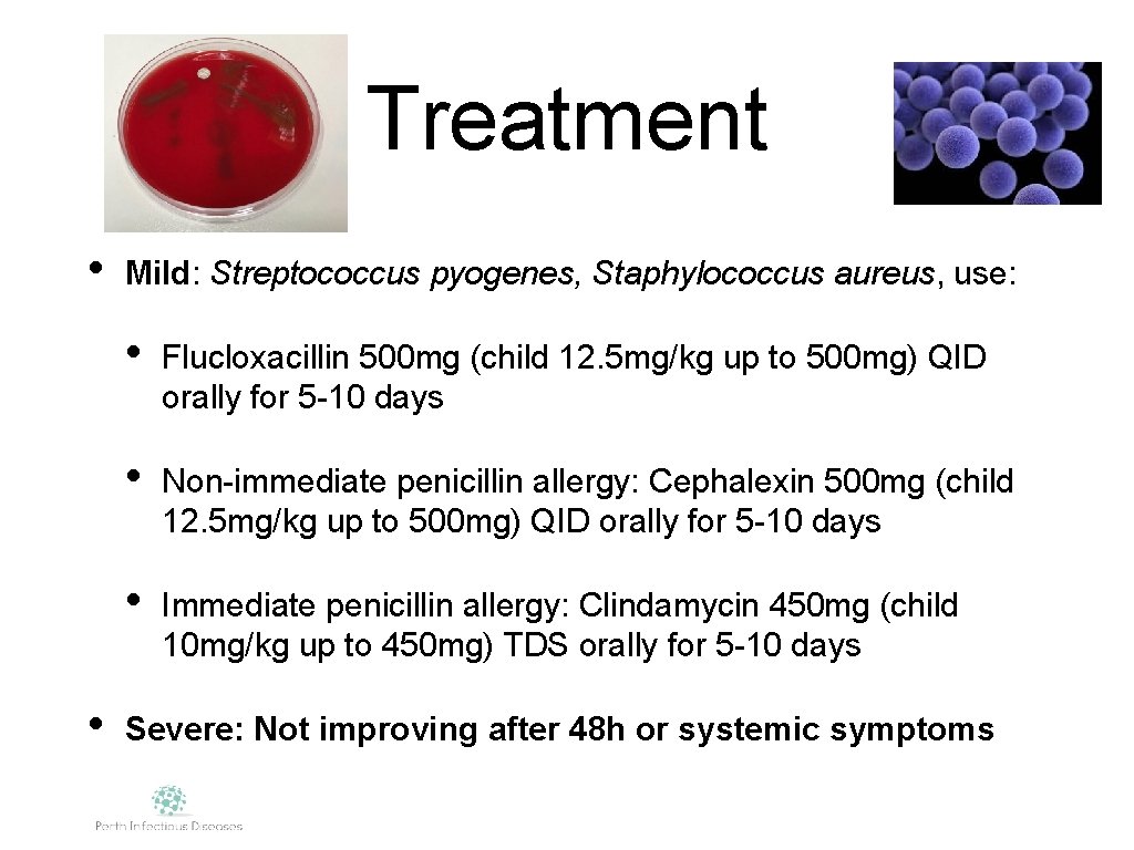 Treatment • • Mild: Streptococcus pyogenes, Staphylococcus aureus, use: • Flucloxacillin 500 mg (child