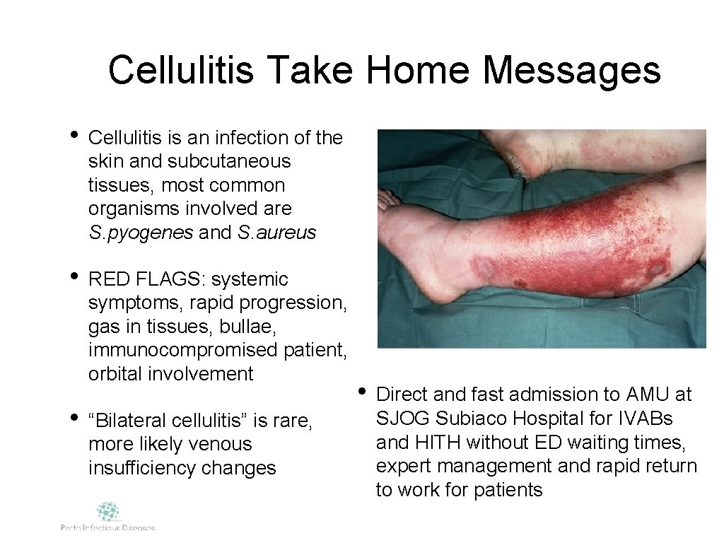Cellulitis Take Home Messages • Cellulitis is an infection of the skin and subcutaneous
