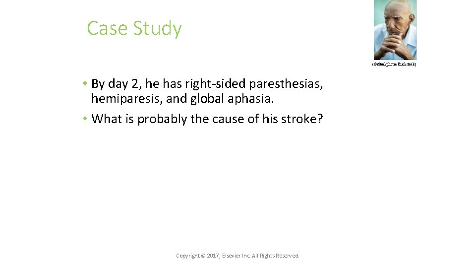 Case Study (©i. Stockphoto/Thinkstock) • By day 2, he has right-sided paresthesias, hemiparesis, and