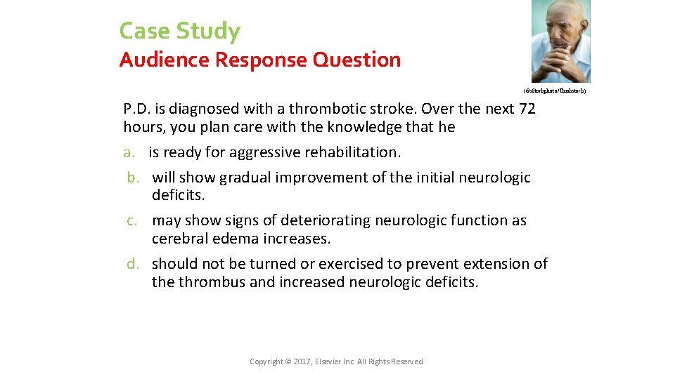 Case Study Audience Response Question (©i. Stockphoto/Thinkstock) P. D. is diagnosed with a thrombotic