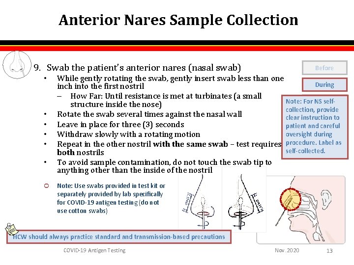 Anterior Nares Sample Collection 9. Swab the patient’s anterior nares (nasal swab) • • Anterior Nares Sample Collection 9. Swab the patient’s anterior nares (nasal swab) • •