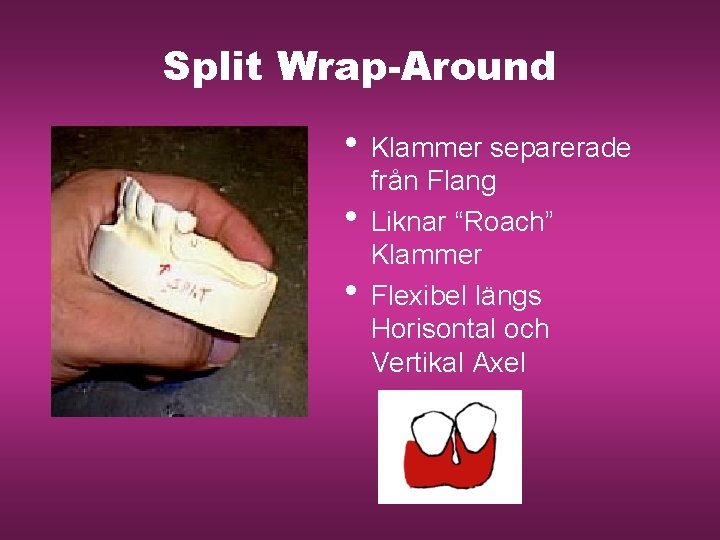 Split Wrap-Around • Klammer separerade • • från Flang Liknar “Roach” Klammer Flexibel längs