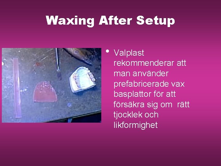 Waxing After Setup • Valplast rekommenderar att man använder prefabricerade vax basplattor för att