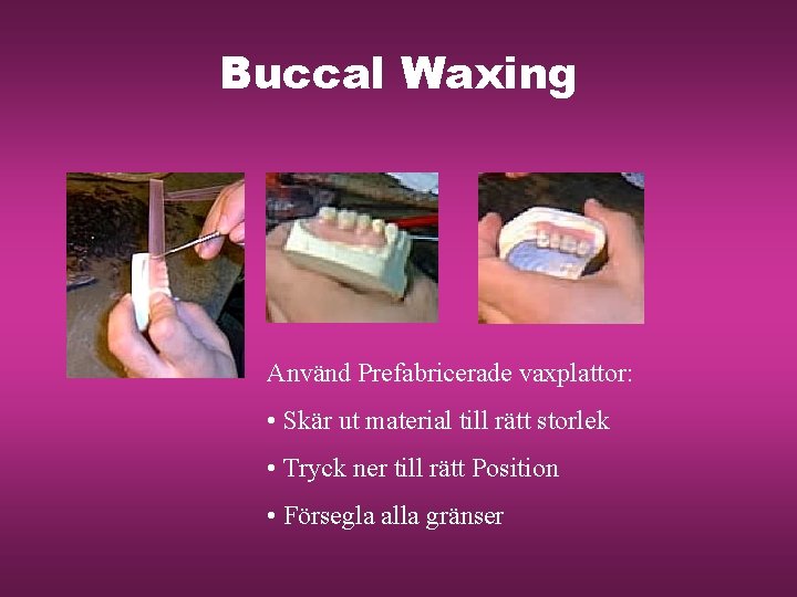 Buccal Waxing Använd Prefabricerade vaxplattor: • Skär ut material till rätt storlek • Tryck
