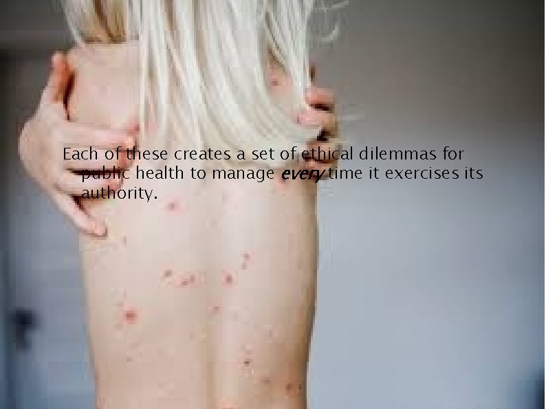 Each of these creates a set of ethical dilemmas for public health to manage Each of these creates a set of ethical dilemmas for public health to manage