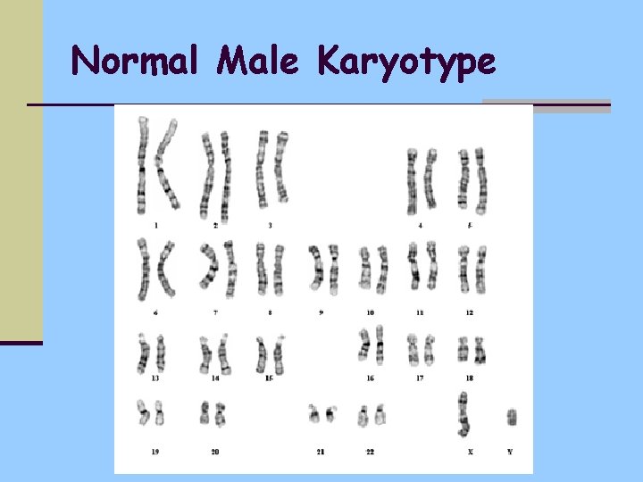 Normal Male Karyotype 