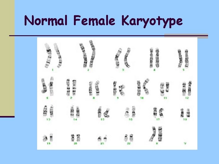Normal Female Karyotype 