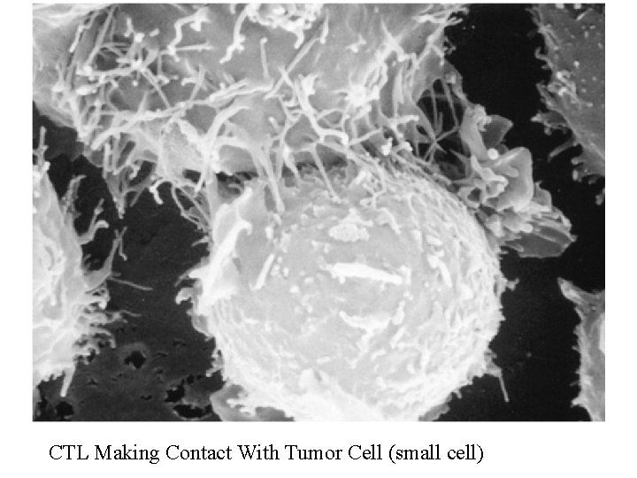 CTL Making Contact With Tumor Cell (small cell) 