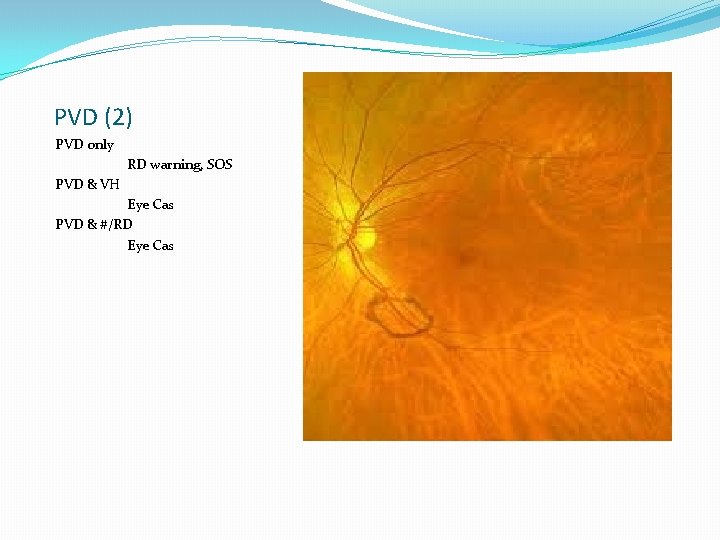 PVD (2) PVD only RD warning, SOS PVD & VH Eye Cas PVD &