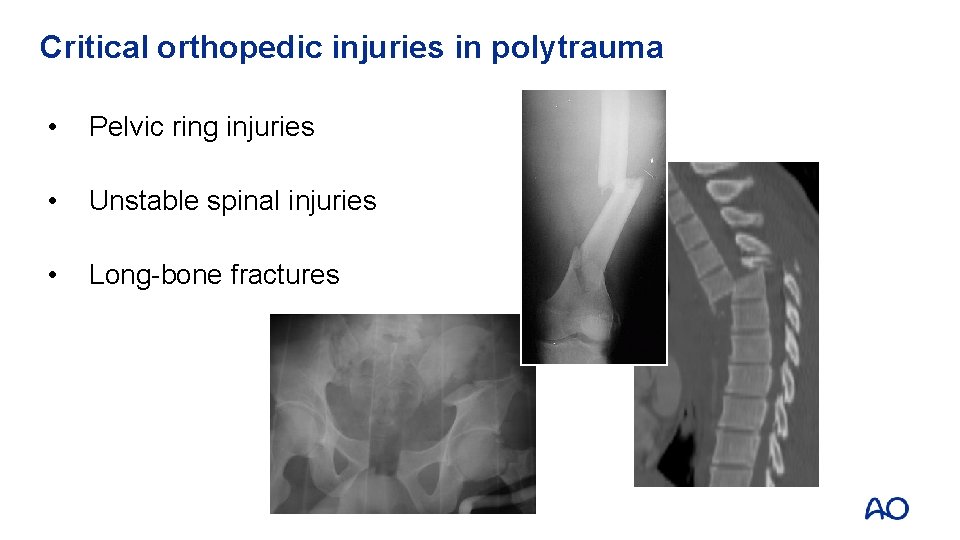 Critical orthopedic injuries in polytrauma • Pelvic ring injuries • Unstable spinal injuries • Critical orthopedic injuries in polytrauma • Pelvic ring injuries • Unstable spinal injuries •
