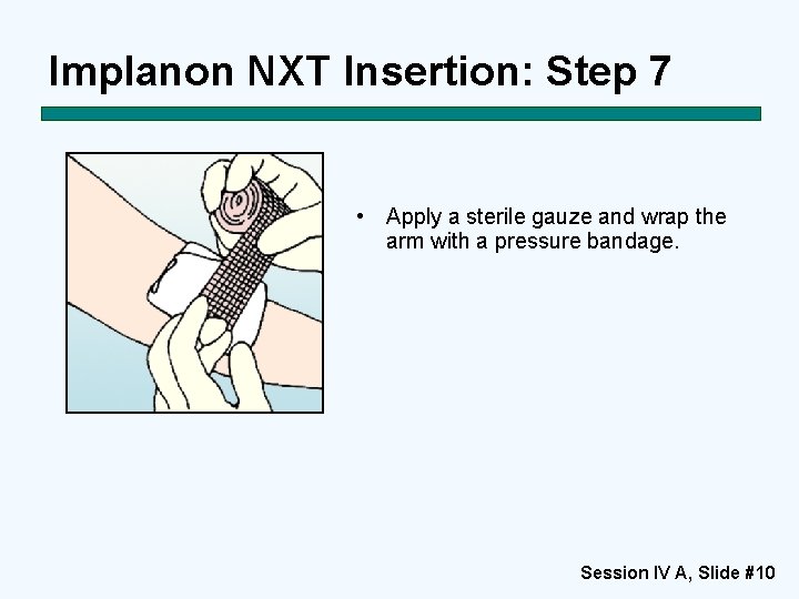 Implanon NXT Insertion: Step 7 • Apply a sterile gauze and wrap the arm