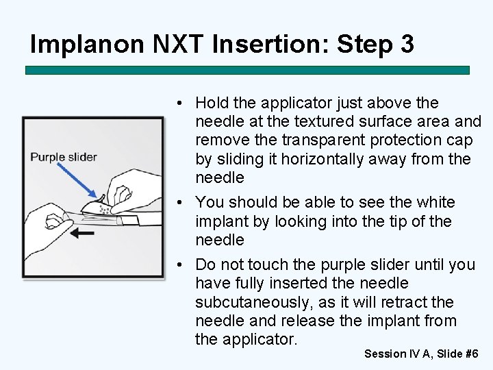 Implanon NXT Insertion: Step 3 • Hold the applicator just above the needle at