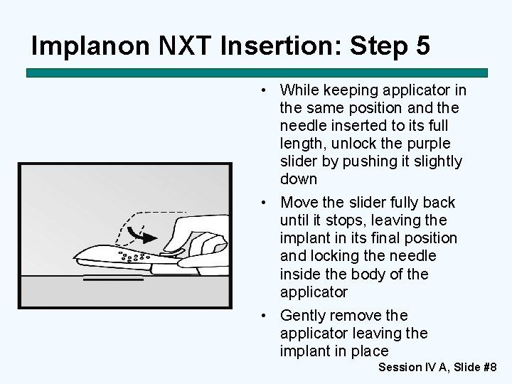 Implanon NXT Insertion: Step 5 • While keeping applicator in the same position and