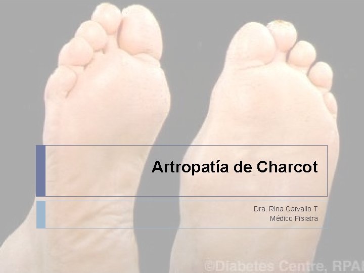 Artropatía de Charcot Dra. Rina Carvallo T Médico Fisiatra 