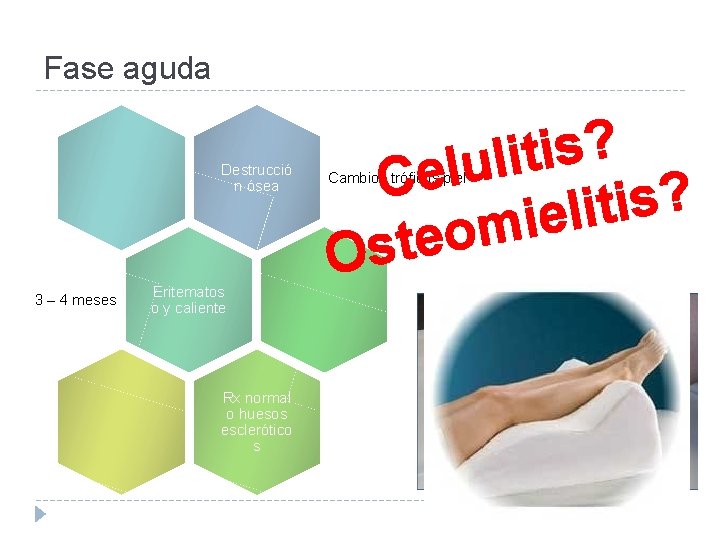 Fase aguda Destrucció n ósea 3 – 4 meses Eritematos o y caliente Rx