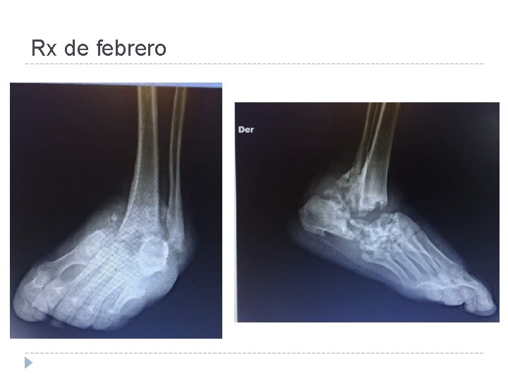 Rx de febrero 