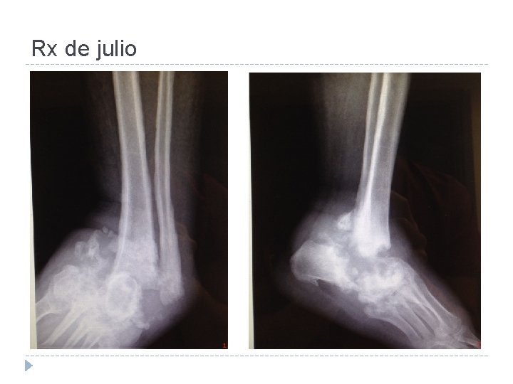 Rx de julio 