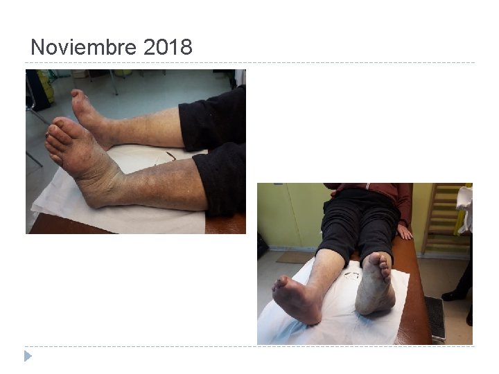 Noviembre 2018 