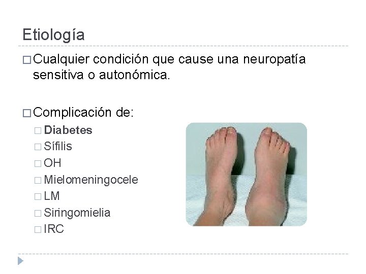 Etiología � Cualquier condición que cause una neuropatía sensitiva o autonómica. � Complicación de:
